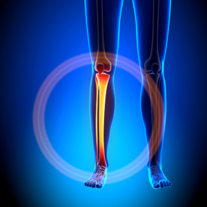 Leg Pain Chiropractic Treatment Gaithersburg, MD