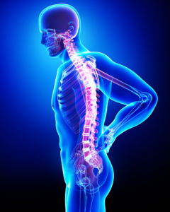Back Pain Doctor Rockville, MD- xray of man holding back